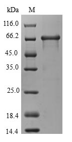 WDR45 Protein - (Tris-Glycine gel) Discontinuous SDS-PAGE (reduced) with 5% enrichment gel and 15% separation gel.