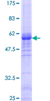 WDR5 Protein - 12.5% SDS-PAGE of human WDR5 stained with Coomassie Blue