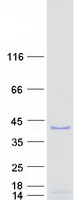 WDR5 Protein - Purified recombinant protein WDR5 was analyzed by SDS-PAGE gel and Coomassie Blue Staining