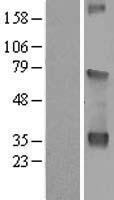 WDR54 Protein - Western validation with an anti-DDK antibody * L: Control HEK293 lysate R: Over-expression lysate