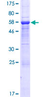 WDR54 Protein - 12.5% SDS-PAGE of human WDR54 stained with Coomassie Blue