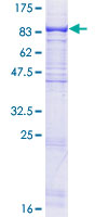 WDR59 Protein - 12.5% SDS-PAGE of human WDR59 stained with Coomassie Blue