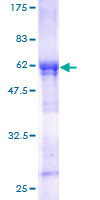 WDR6 Protein - 12.5% SDS-PAGE of human WDR6 stained with Coomassie Blue