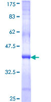 WDR6 Protein - 12.5% SDS-PAGE Stained with Coomassie Blue.