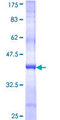 WDR6 Protein - 12.5% SDS-PAGE Stained with Coomassie Blue.