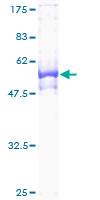 WDR61 Protein - 12.5% SDS-PAGE of human REC14 stained with Coomassie Blue