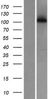 WDR63 Protein - Western validation with an anti-DDK antibody * L: Control HEK293 lysate R: Over-expression lysate