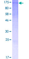WDR63 Protein - 12.5% SDS-PAGE of human WDR63 stained with Coomassie Blue