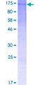 WDR63 Protein - 12.5% SDS-PAGE of human WDR63 stained with Coomassie Blue