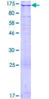 WDR66 Protein - 12.5% SDS-PAGE of human WDR66 stained with Coomassie Blue