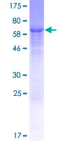 WDR73 Protein - 12.5% SDS-PAGE of human WDR73 stained with Coomassie Blue