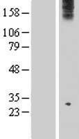 WDR75 Protein - Western validation with an anti-DDK antibody * L: Control HEK293 lysate R: Over-expression lysate