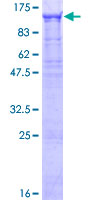 WDR75 Protein - 12.5% SDS-PAGE of human WDR75 stained with Coomassie Blue
