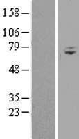 WDR76 Protein - Western validation with an anti-DDK antibody * L: Control HEK293 lysate R: Over-expression lysate
