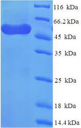 WDR77 / MEP50 Protein