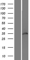 WDR82 / TMEM113 Protein - Western validation with an anti-DDK antibody * L: Control HEK293 lysate R: Over-expression lysate