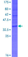 WDR82 / TMEM113 Protein
