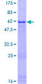 WDR83 Protein - 12.5% SDS-PAGE of human MORG1 stained with Coomassie Blue