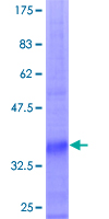 WDR83 Protein - 12.5% SDS-PAGE Stained with Coomassie Blue.
