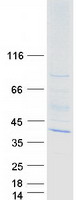 WDR83 Protein - Purified recombinant protein WDR83 was analyzed by SDS-PAGE gel and Coomassie Blue Staining
