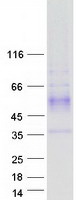 WDR83 Protein - Purified recombinant protein WDR83 was analyzed by SDS-PAGE gel and Coomassie Blue Staining