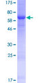 WDR89 Protein - 12.5% SDS-PAGE of human WDR89 stained with Coomassie Blue
