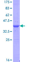 WDR9 / BRWD1 Protein - 12.5% SDS-PAGE of human BRWD1 stained with Coomassie Blue