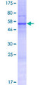 WDR90 Protein - 12.5% SDS-PAGE of human WDR90 stained with Coomassie Blue