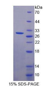 WDR90 Protein - Recombinant WD Repeat Containing Domain Protein 90 (WDR90) by SDS-PAGE