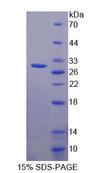 WDR90 Protein - Recombinant WD Repeat Containing Domain Protein 90 (WDR90) by SDS-PAGE