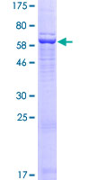 WDR92 Protein - 12.5% SDS-PAGE of human WDR92 stained with Coomassie Blue