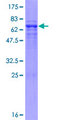 WDSUB1 Protein - 12.5% SDS-PAGE of human WDSUB1 stained with Coomassie Blue