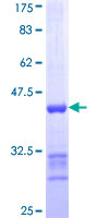 WDSUB1 Protein - 12.5% SDS-PAGE Stained with Coomassie Blue.