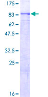 WDTC1 Protein - 12.5% SDS-PAGE of human WDTC1 stained with Coomassie Blue