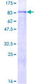 WDTC1 Protein - 12.5% SDS-PAGE of human WDTC1 stained with Coomassie Blue