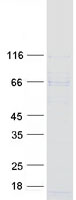 WDTC1 Protein - Purified recombinant protein WDTC1 was analyzed by SDS-PAGE gel and Coomassie Blue Staining