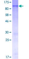 WEE1 Protein - 12.5% SDS-PAGE of human WEE1 stained with Coomassie Blue