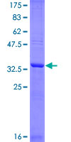 WEE1 Protein - 12.5% SDS-PAGE Stained with Coomassie Blue.
