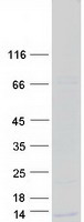 WFDC10A Protein - Purified recombinant protein WFDC10A was analyzed by SDS-PAGE gel and Coomassie Blue Staining