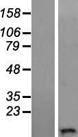 WFDC11 Protein - Western validation with an anti-DDK antibody * L: Control HEK293 lysate R: Over-expression lysate