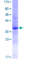 WFDC12 Protein - 12.5% SDS-PAGE of human WFDC12 stained with Coomassie Blue