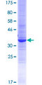 WFDC12 Protein - 12.5% SDS-PAGE of human WFDC12 stained with Coomassie Blue