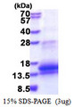 WFDC12 Protein