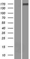 WFDC13 Protein - Western validation with an anti-DDK antibody * L: Control HEK293 lysate R: Over-expression lysate