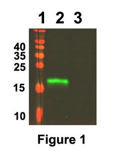 WFDC2 / HE4 Protein