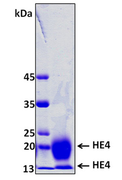 WFDC2 / HE4 Protein