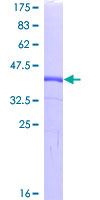 WFDC2 / HE4 Protein - 12.5% SDS-PAGE of human WFDC2 stained with Coomassie Blue