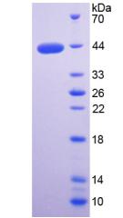 WFDC2 / HE4 Protein - Recombinant WAP Four Disulfide Core Domain Protein 2 By SDS-PAGE