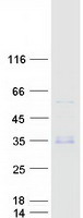 WFDC3 Protein - Purified recombinant protein WFDC3 was analyzed by SDS-PAGE gel and Coomassie Blue Staining