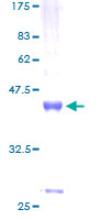 WFDC5 / PRG5 Protein - 12.5% SDS-PAGE of human WFDC5 stained with Coomassie Blue